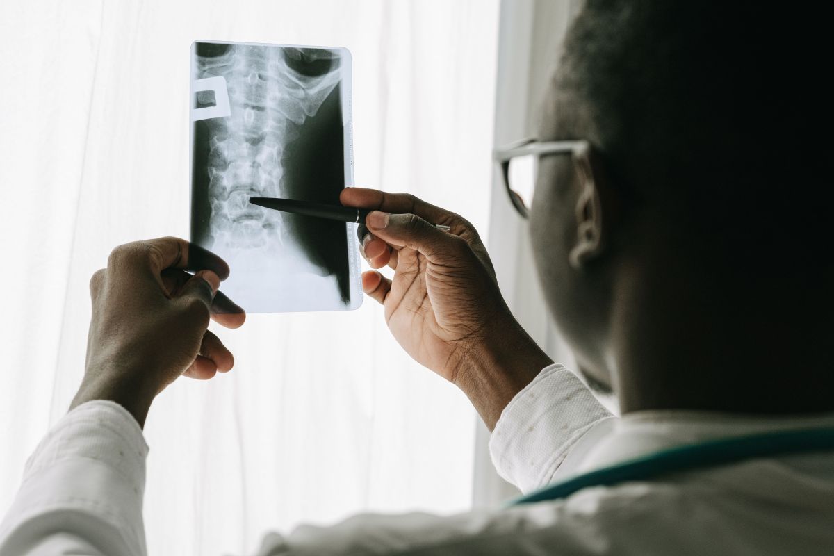 Digital X-ray